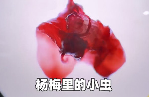 买杨梅送蛋白质？还有这种好事
